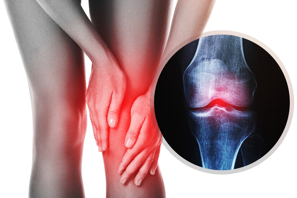 5 Common Causes of Hip Pain and joint pain supplements