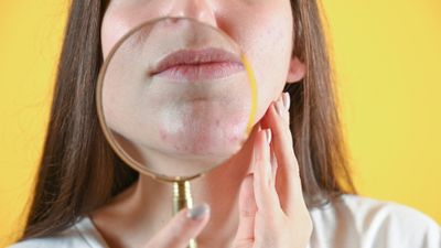 Woman examining red spots on chin with a magnifying glass