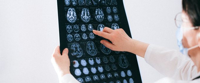 Female doctor examining scans of someone's brain activity