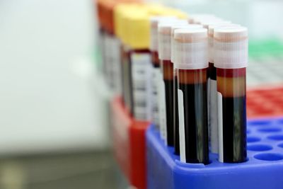 a row of blood test tubes sitting on top of a blue rack
