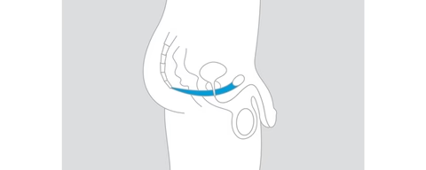 a diagram of a knee with a blue band around it