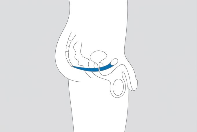 Diagram of the male pelvic floor showing the bulbospongiosus and ischiocavernosus muscles at the base of the pelvis
