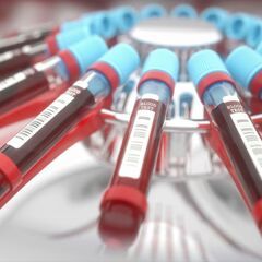 a group blood tests sitting on top of a metal tray