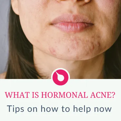 a woman with acne on her face