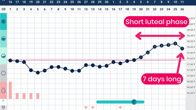 A Tempdrop chart showing a short luteal phase (or luteal phase defect - LPD)