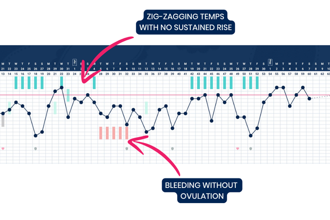 A fertility chart showing no ovulation and intermittent bleeding