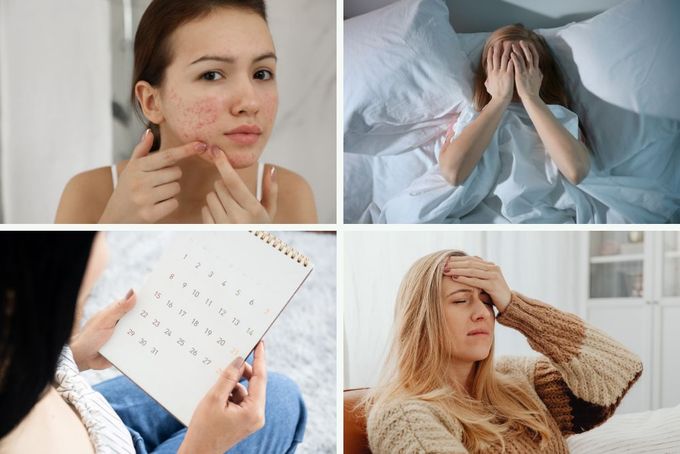 a collage of photos of a woman with acne on her face