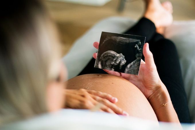 a pregnant woman holding a picture of a dog