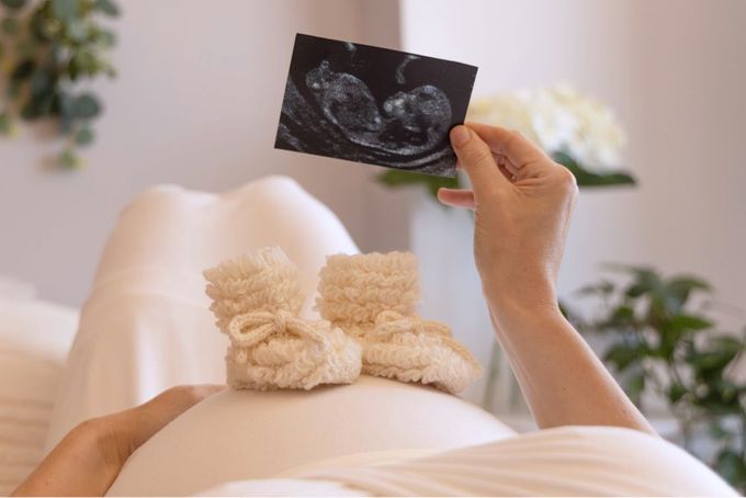 a pregnant woman holding a card with a picture of a baby